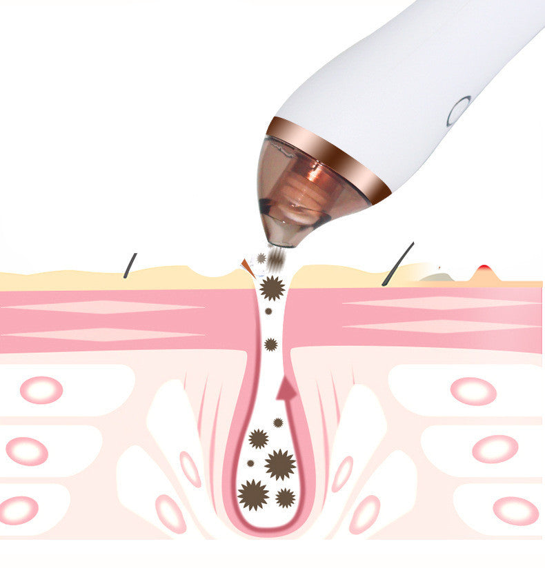 4-in-1 Body Gua Sha Cupping Machine