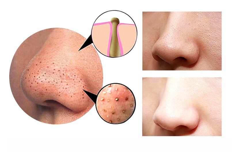 4-in-1 Body Gua Sha Cupping Machine